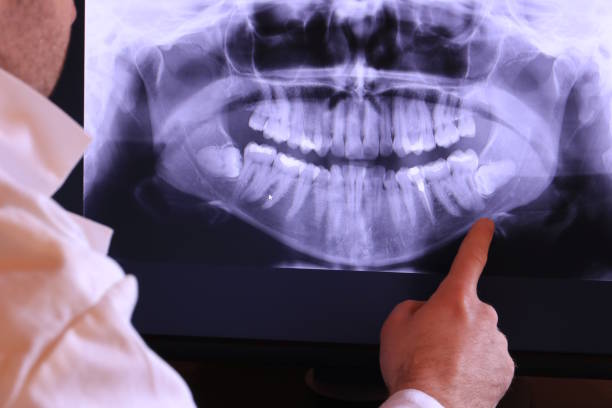 Best Emergency Dental Services for Seniors in Dewitt, MI
