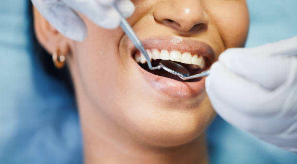 Best Broken or Cracked Tooth Emergency Dentist in Dewitt, MI