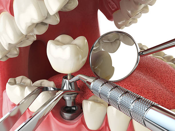 Best Orthodontic Emergency Dentist in Dewitt, MI
